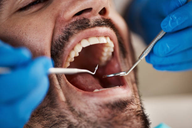 Best Broken or Chipped Tooth Repair in Honaker, VA