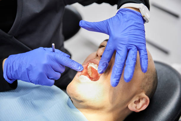 Best Emergency Root Canal Therapy in Honaker, VA
